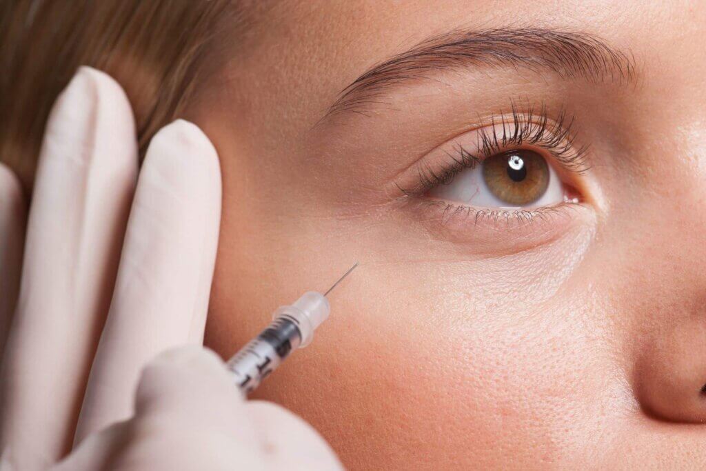 How Carboxytherapy is Used to Lighten Dark Circles