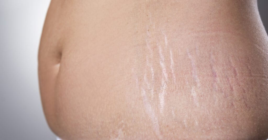 Treating Marks with Reem Tryaq